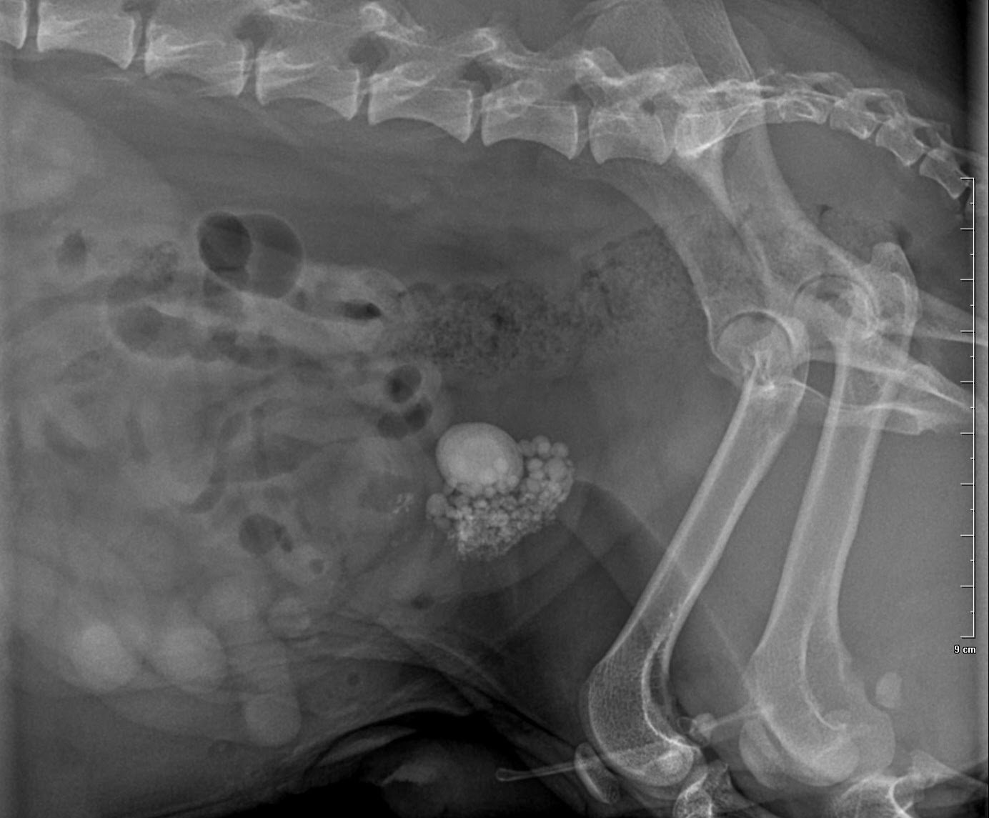 Bladder stone(s) radiograph